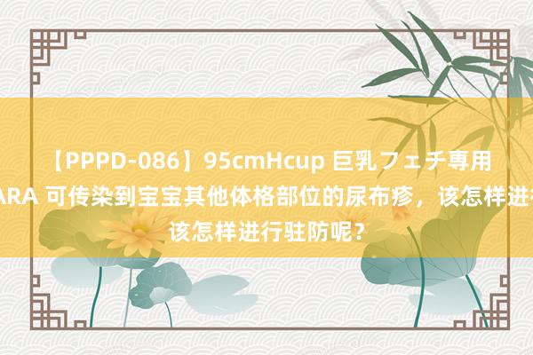 【PPPD-086】95cmHcup 巨乳フェチ専用ソープ SARA 可传染到宝宝其他体格部位的尿布疹，该怎样进行驻防呢？